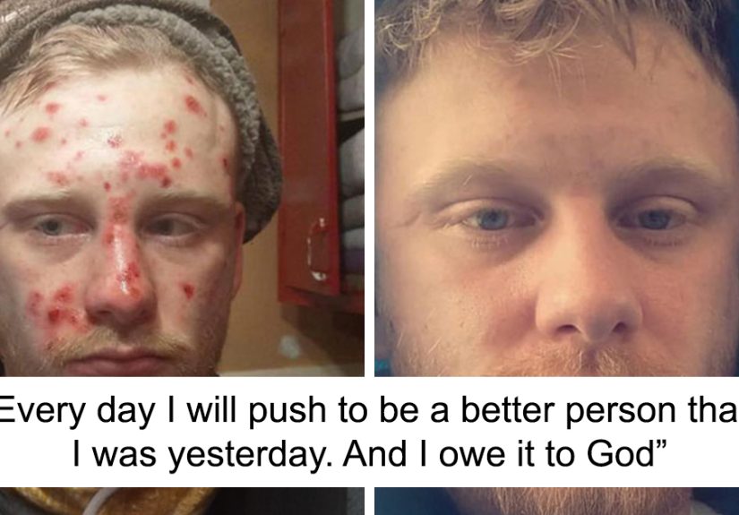 50 Inspiring Stories Of People Recovering And Rebuilding Their Lives
