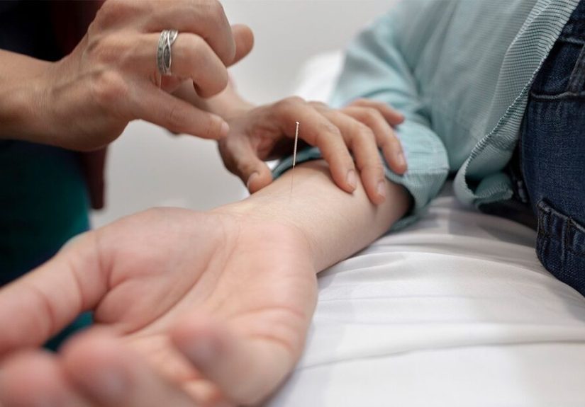 Can Acupuncture Help Treat Erectile Dysfunction?