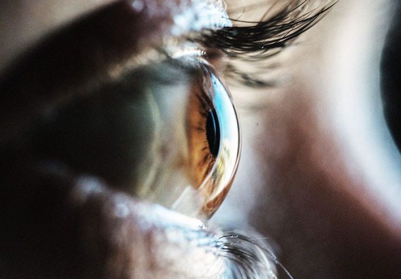 Can diabetes lead to vision loss?