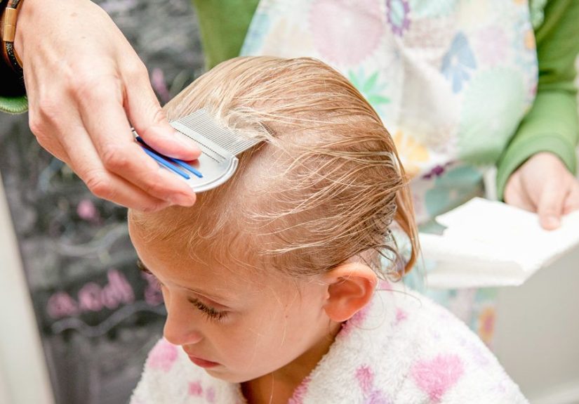 Head Lice Infestation: Causes, Symptoms & Diagnosis