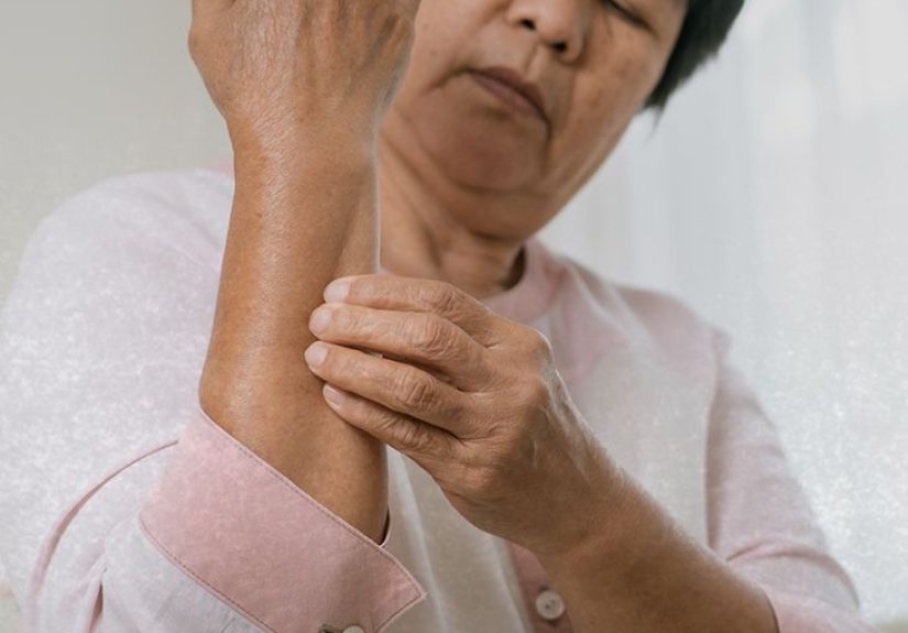 Hives (urticaria): Causes, symptoms, and treatments