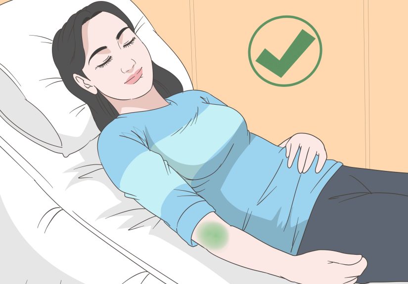 How to Treat a Pinched Nerve