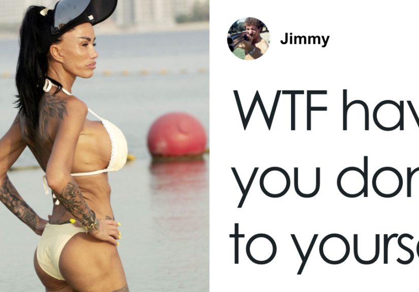 Katie Price Reveals Painful Back Filler Side Effect That Keeps Her Awake After Trying To Fix Her ‘Deflated Balloon’