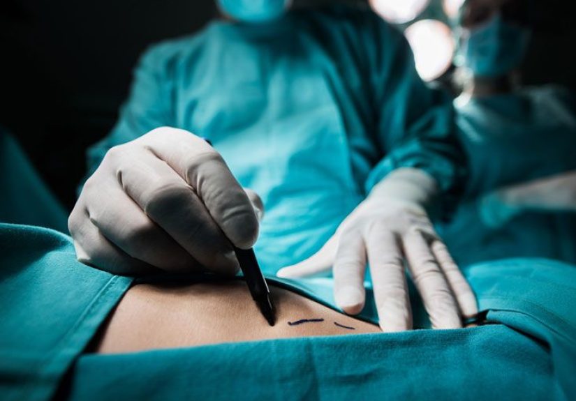 10 Common Plastic Surgery Complications: Hematoma, Infection, More