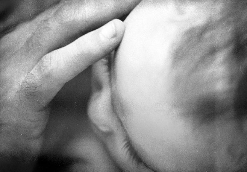 Blueberry muffin rash from rubella: Pictures, causes, and more