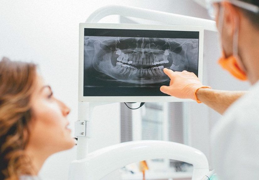 Dental X-Rays: Purpose, Procedure, and Risks