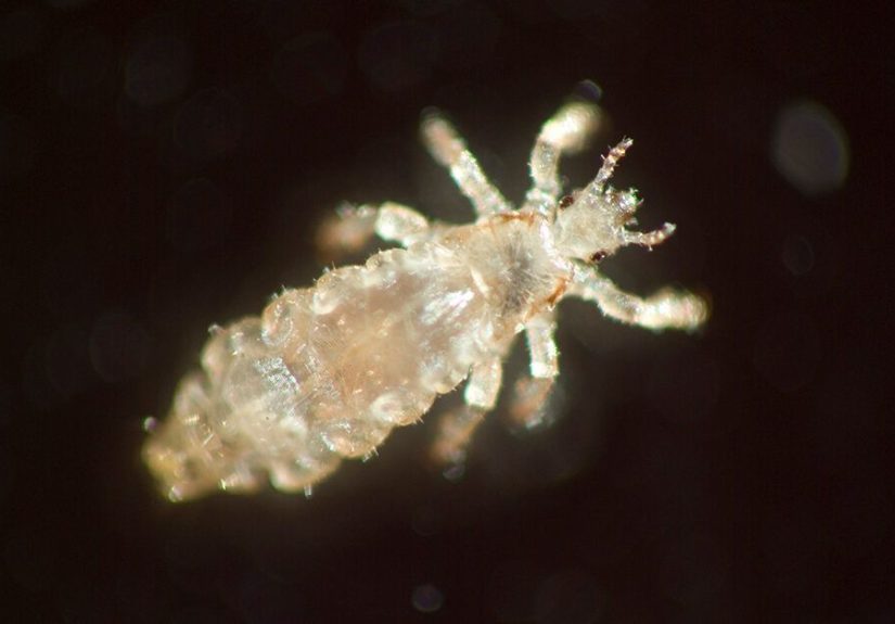 How Common Are Lice? Prevalence, Myths, Prevention