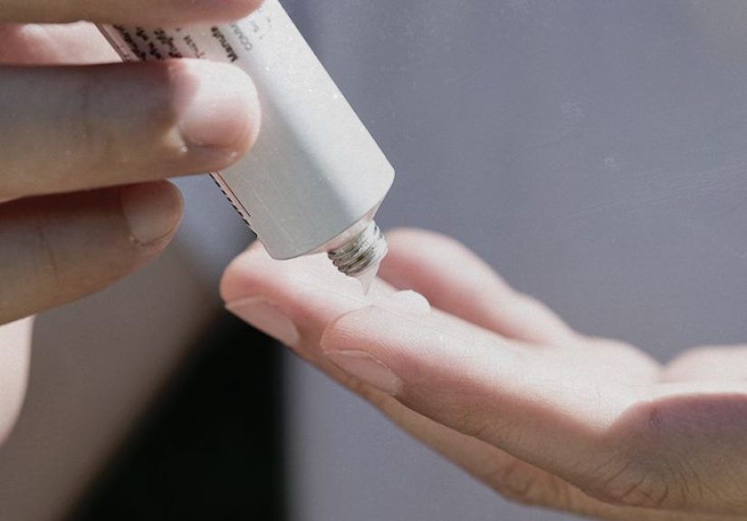 How do steroid creams help treat eczema?