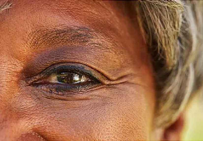 Living With Neuromyelitis Optica