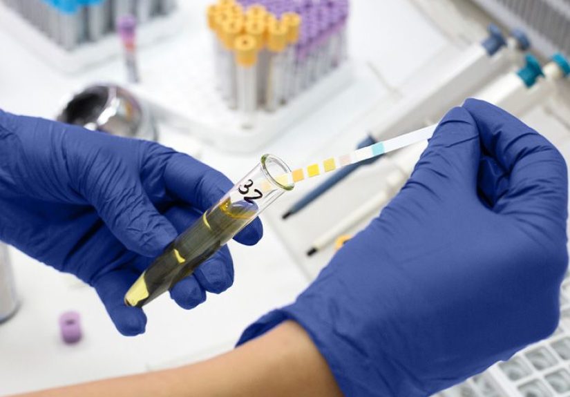 Understanding the stages of renal failure