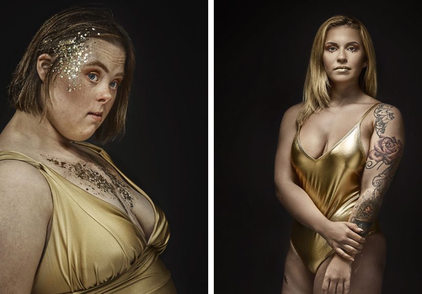 We Photographed 18 Women With Disabilities To Celebrate Their Uniqueness