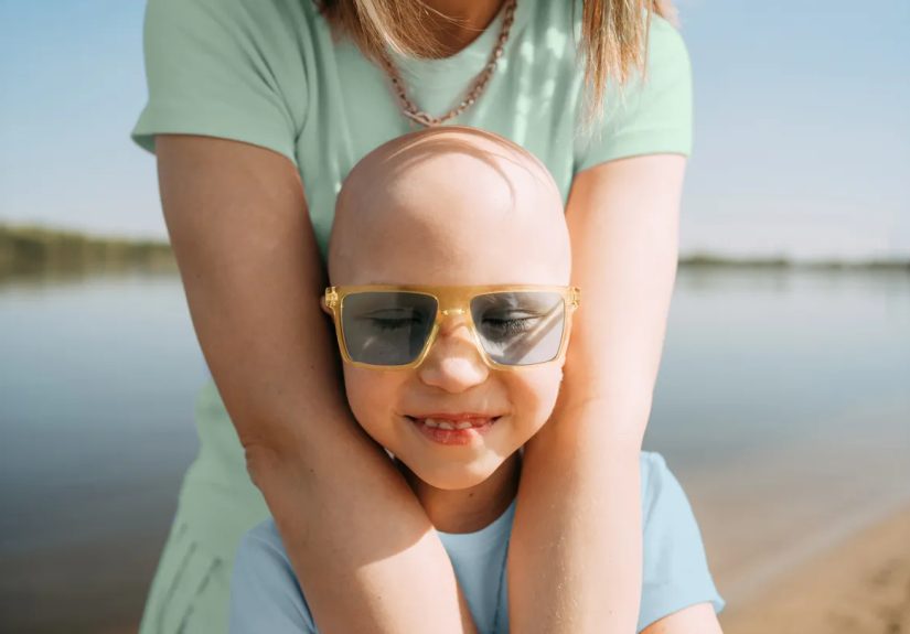 Alopecia in Children