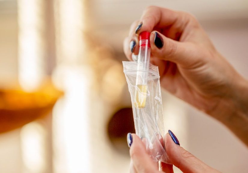 Diluted Urine in Drug Tests: How to Ensure Accuracy