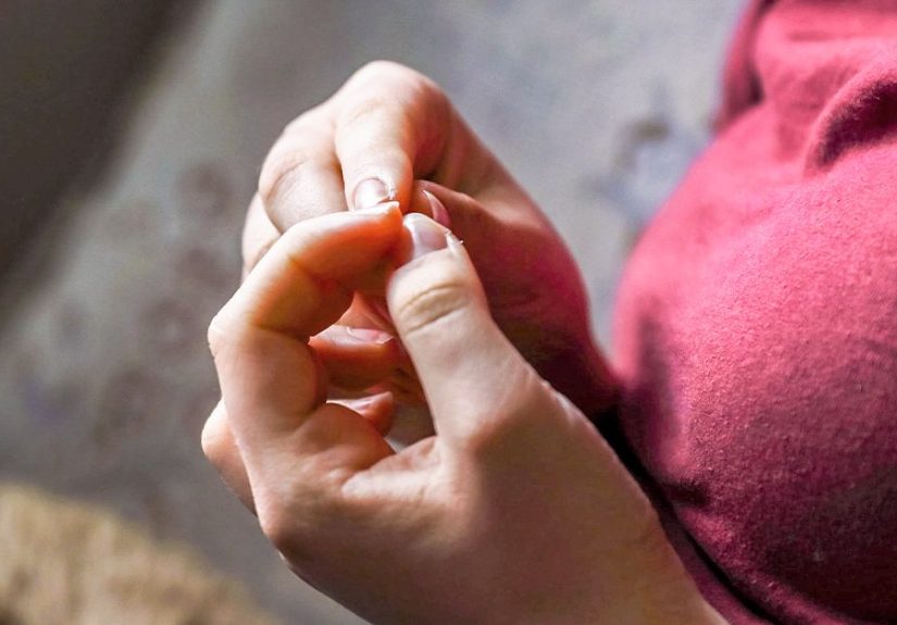 Disappearing Nail Bed: Symptoms, Causes, Diagnosis, Treatment