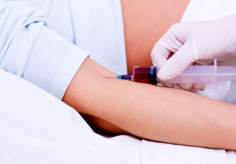 Epstein-Barr Virus (EBV) Test: Purpose, Procedure, and Risks