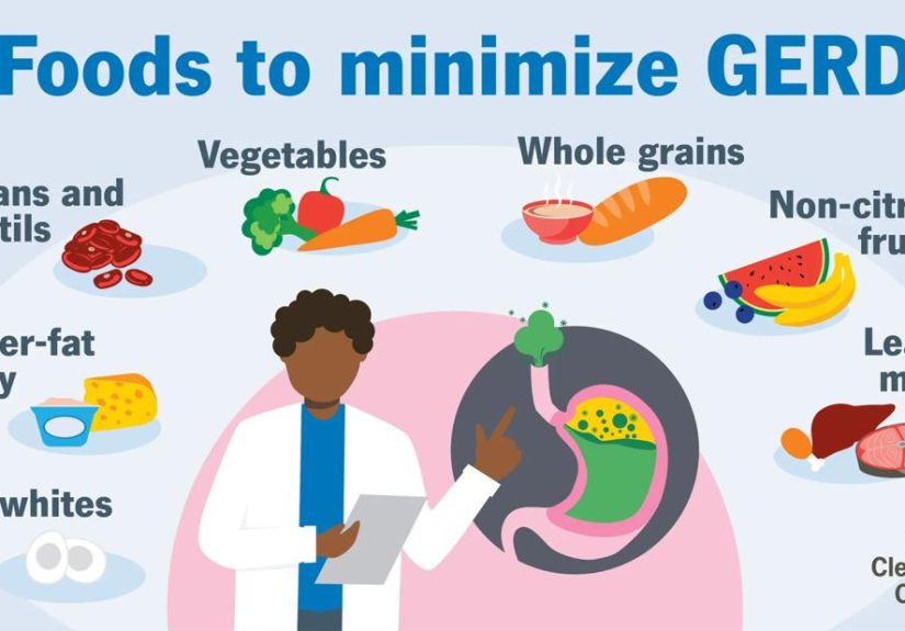 GERD Diet: Foods To Eat and Avoid