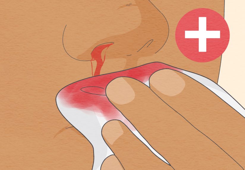 How to Know If You Have Internal Bleeding: Symptoms & More