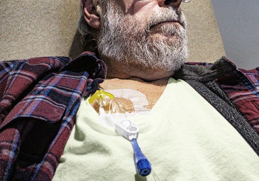 Stage 4 colon cancer life expectancy and survival rates