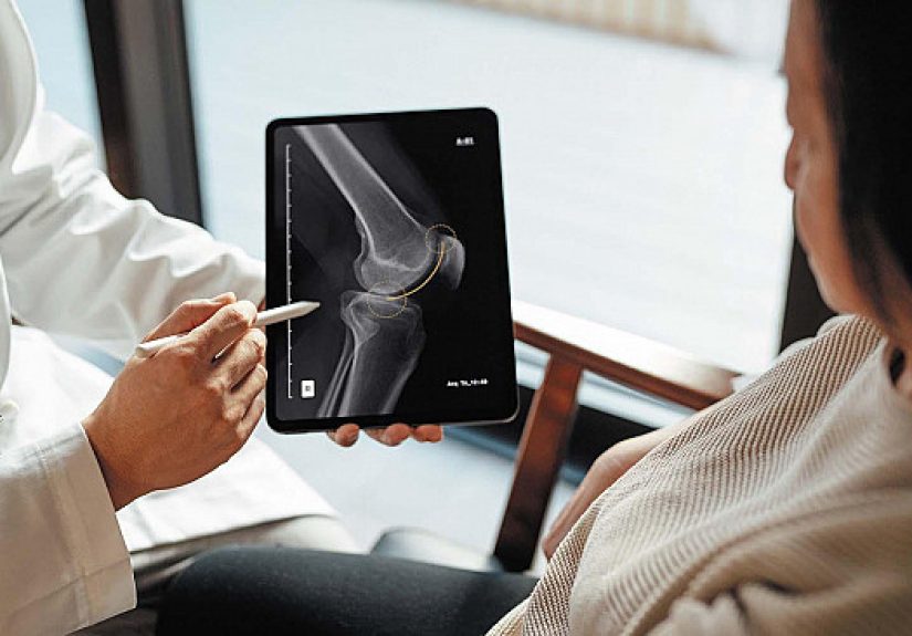 When does an injury require an x-ray? - Harvard Health
