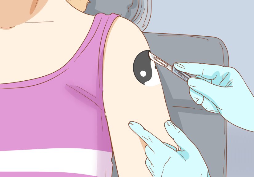 3 Ways to Fade Tattoos