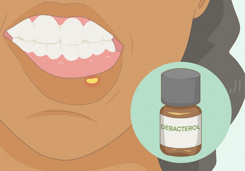 4 Ways to Treat Canker Sores (Home Remedies)