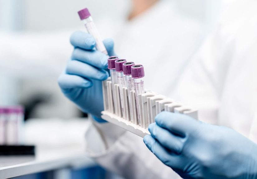Acanthocytes: Associated Conditions and Symptoms