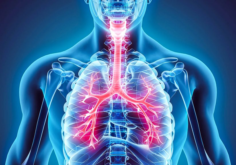 Bronchitis (Acute and Chronic): Symptoms, Causes & Treatment