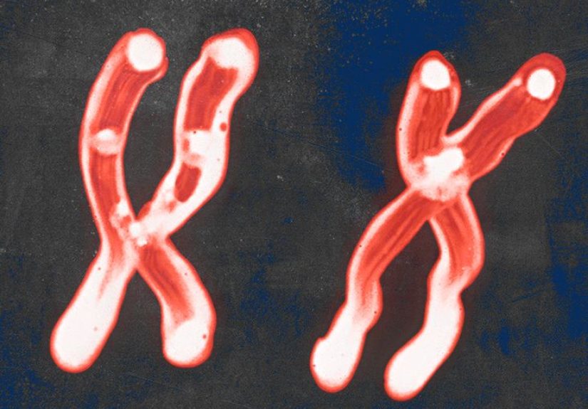 Chronic myeloid leukemia and karyotypes: What to know