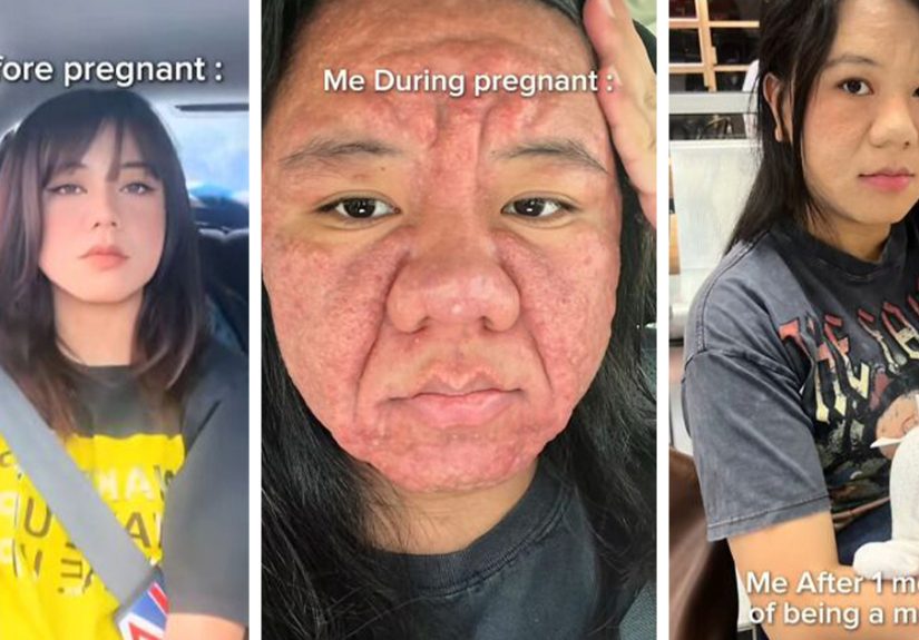 “From Dressing Like A Wild Animal To Raising A Wild Animal”: 50 Candid Photos Of Moms Before And After Kids That Hit Hard