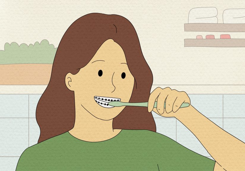 How to Prepare on the Day You Get Braces: 15 Steps