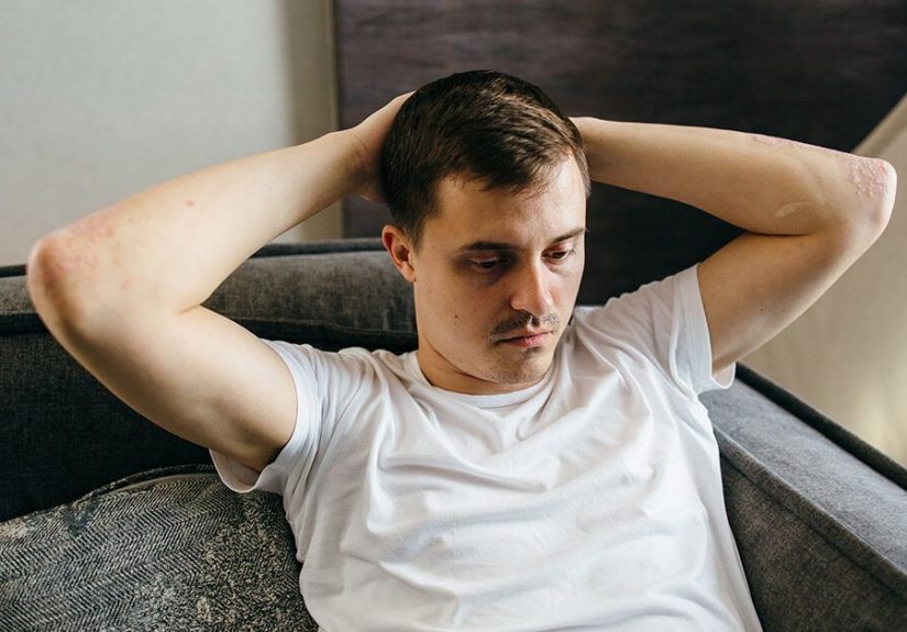 What We Know About Long COVID and How Long Symptoms Last